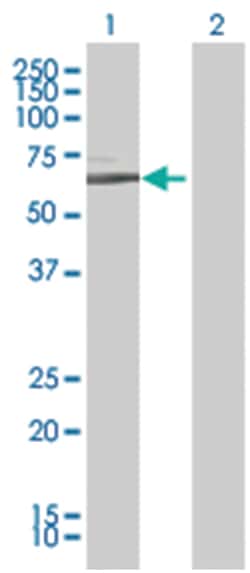 IFNGR1 293T Cell Overexpression Lysate (Denatured), Abnova 100 &mu;L | Buy Online | Abnova | Fisher Scientific