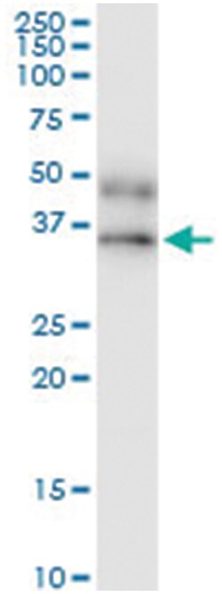 anti-IFNGR2, Human, IP-WB Antibody Pair, Abnova™