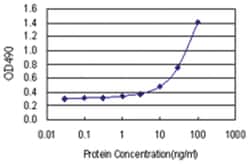 anti-IGFBP2 Matched Antibody Pair, Abnova&trade;