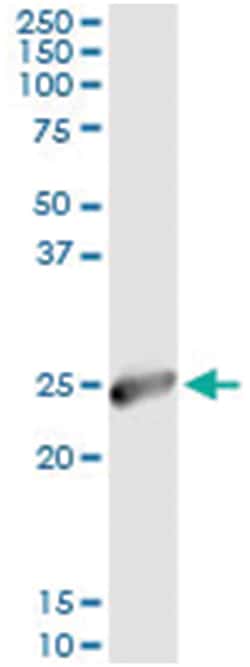 IGKC, Human, IP-WB Antibody Pair (PW1), Abnova&trade;