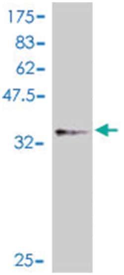 IL1B, Mouse, Polyclonal Antibody, Abnova 50&mu;L; Unlabeled:Antibodies,