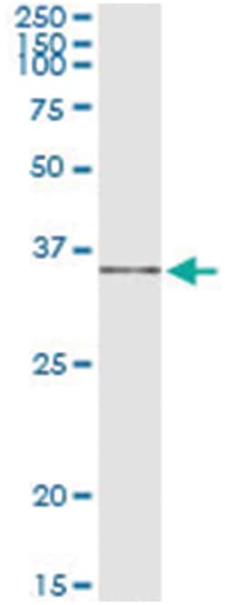 IL1B, Human, IP-WB Antibody Pair (PW2), Abnova&trade;