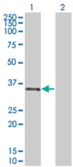 IL1B 293T Cell Overexpression Lysate (Denatured), Abnova