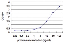 IL1RN, Human, Matched Antibody Pair (AP41), Abnova&trade;