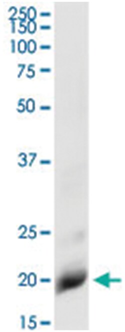 IL1RN, Human, IP-WB Antibody Pair (PW2), Abnova&trade;