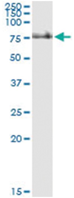 anti-IL2RB, Human, IP-WB Antibody Pair, Abnova&trade;