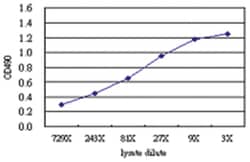 anti-IL6 Matched Antibody Pair, Abnova&trade;