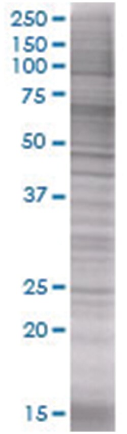 IL6 293T Cell Overexpression Lysate (Denatured), Abnova