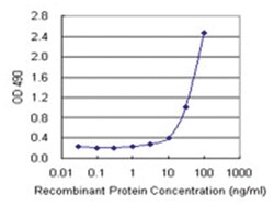 anti-IL6R, Human, Matched Antibody Pair, Abnova™