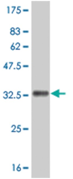 IL8, Mouse, Clone: 1D6, Abnova 100 &mu;g | Buy Online | Abnova Corporation | Fisher Scientific