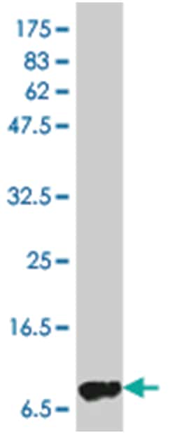 IL8, Mouse, Clone: 4H1, Abnova 100&mu;g; Unlabeled:Antibodies, Monoclonal