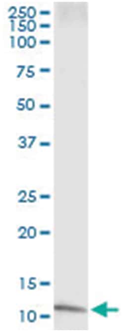 IL8, Human, IP-WB Antibody Pair (PW1), Abnova&trade;