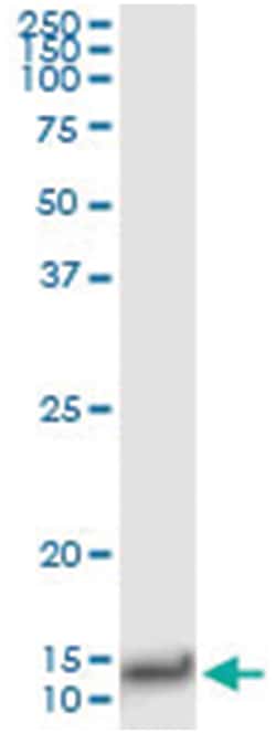 IL8, Human, IP-WB Antibody Pair (PW4), Abnova&trade;