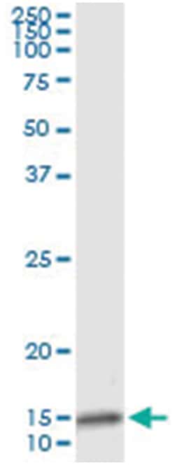 IL8, Human, IP-WB Antibody Pair (PW5), Abnova™