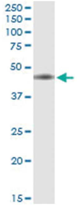 anti-IL10RB, Human, IP-WB Antibody Pair, Abnova 1 Set:Antibodies, Monoclonal/Polyclonal