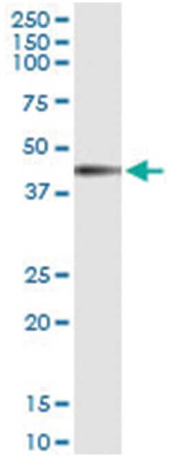 anti-IL12RB1, Human, IP-WB Antibody Pair, Abnova 1 Set:Antibodies, Monoclonal/Polyclonal