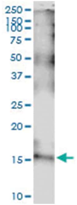 anti-IL15, Human, IP-WB Antibody Pair, Abnova&trade;