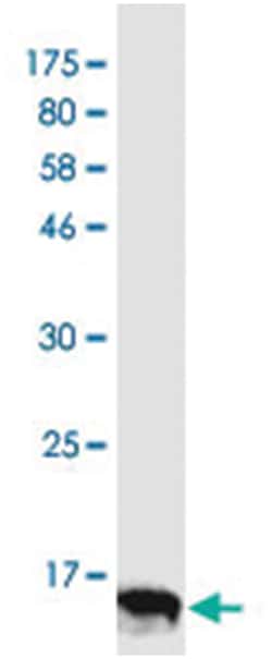 anti-TNFRSF9, Clone: 5F8, Abnova 100 &mu;g | Buy Online | Abnova | Fisher Scientific