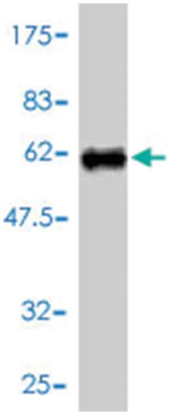 inositol(myo)-1(or 4)-monophosphatase 1 (A01), Mouse anti-Human, Polyclonal Antibody, Abnova 50 &mu;L | Buy Online | Abnova Corporation | Fisher Scientific