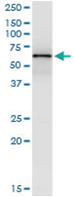anti-IMPDH1, Human, IP-WB Antibody Pair, Abnova&trade;
