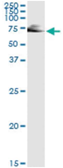 anti-IMPDH2, Human, IP-WB Antibody Pair, Abnova&trade;