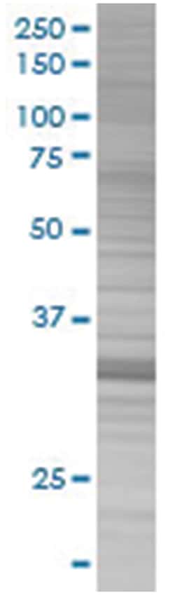 ING2 293T Cell Overexpression Lysate 2 (Denatured), Abnova 100 &mu;L | Buy Online | Abnova | Fisher Scientific