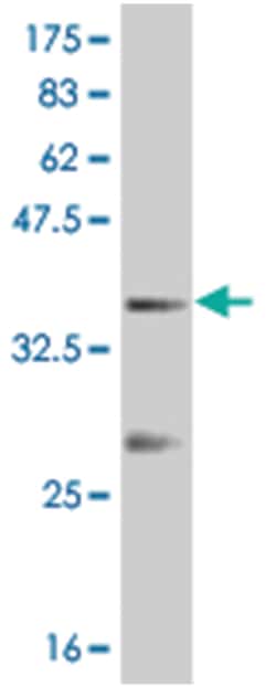 pancreatic and duodenal homeobox 1, Mouse, Clone: 3F10, Abnova 100&mu;g;