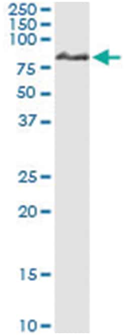 IRAK1, Human, IP-WB Antibody Pair (PW3), Abnova&trade;