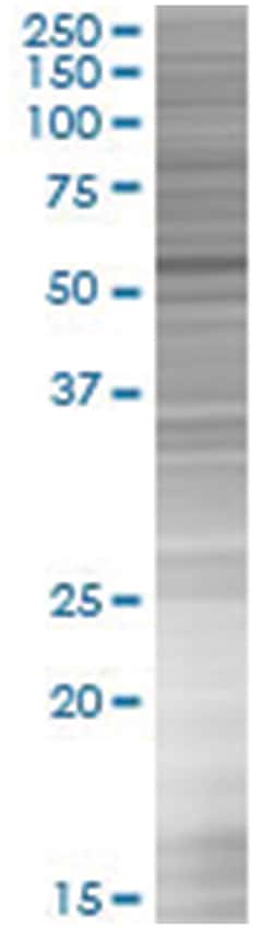 IRF2 293T Cell Overexpression Lysate (Denatured), Abnova 100 &mu;L | Buy Online | Abnova | Fisher Scientific