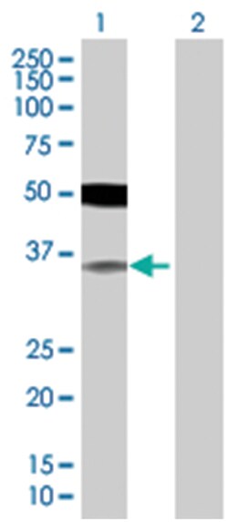 IRF2 293T Cell Overexpression Lysate (Denatured), Abnova 100 &mu;L | Buy Online | Abnova | Fisher Scientific