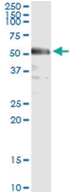 IRF3, Human, IP-WB Antibody Pair (PW2), Abnova&trade;