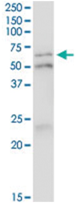 anti-IRF5, Human, IP-WB Antibody Pair, Abnova 1 Set:Antibodies, Monoclonal/Polyclonal