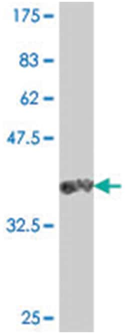 ITGA2, Mouse, Polyclonal Antibody, Abnova 50 &mu;L | Buy Online | Abnova | Fisher Scientific