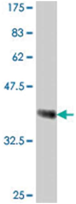 ITGA4, Mouse, Polyclonal Antibody, Abnova 50 &mu;L | Buy Online | Abnova | Fisher Scientific