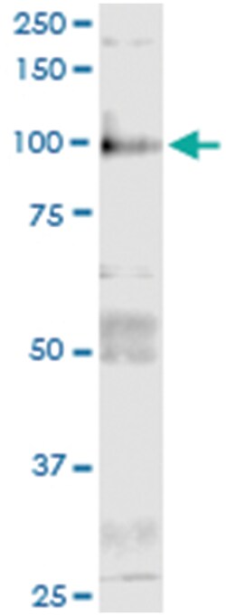 anti-ITGB6, Human, IP-WB Antibody Pair, Abnova™