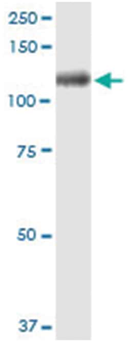 anti-ITIH1, Human, IP-WB Antibody Pair, Abnova 1 Set:Antibodies, Monoclonal/Polyclonal