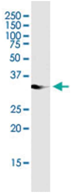 anti-ITPK1, Human, IP-WB Antibody Pair, Abnova 1 Set:Antibodies, Monoclonal/Polyclonal