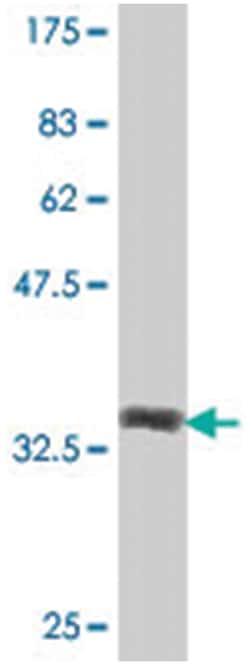 Janus kinase 1 (a protein tyrosine kinase), Mouse, Polyclonal Antibody,