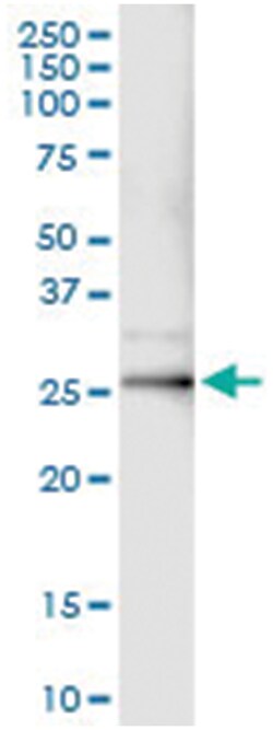 anti-JUNB, Human, IP-WB Antibody Pair, Abnova™