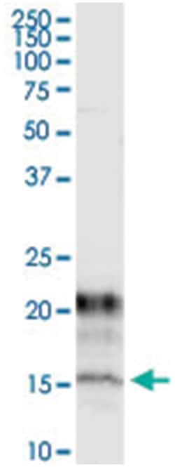 anti-KCNE1, Human, IP-WB Antibody Pair, Abnova&trade;