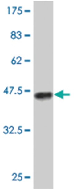 KCNJ1, Mouse, Polyclonal Antibody, Abnova 50&mu;L; Unlabeled:Antibodies,