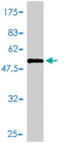KHK (A01), Mouse anti-Human, Polyclonal Antibody, Abnova 50&mu;L; Unlabeled:Antibodies,