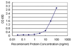 anti-KHK Matched Antibody Pair, Abnova 1 Set, Unlabeled:Antibodies, Monoclonal/Polyclonal
