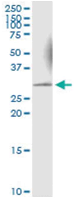 anti-KHK, Human, IP-WB Antibody Pair, Abnova&trade;