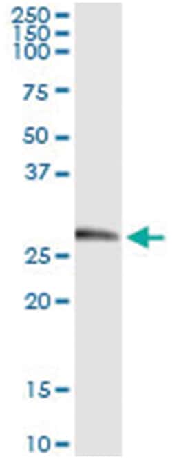 KLK2, Human, IP-WB Antibody Pair (PW2), Abnova 1 Set:Antibodies, Monoclonal/Polyclonal