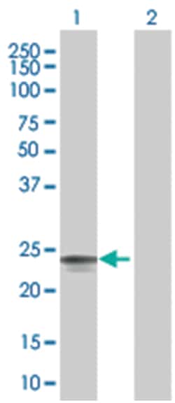KLK2 293T Cell Overexpression Lysate (Denatured), Abnova 100 &mu;l | Buy Online | Abnova | Fisher Scientific
