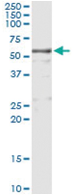 KNG1, Human, IP-WB Antibody Pair (PW2), Abnova™