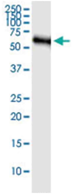 KNG1, Human, IP-WB Antibody Pair (PW3), Abnova&trade;