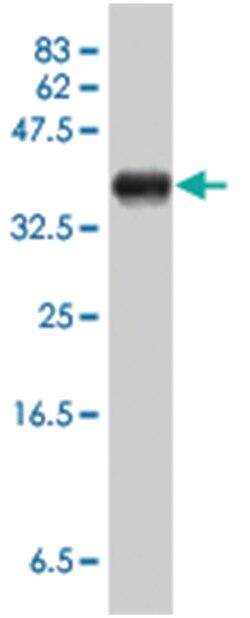 KPNA2, Mouse, Polyclonal Antibody, Abnova 50 &mu;L | Buy Online | Abnova Corporation | Fisher Scientific