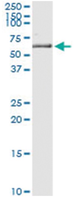 anti-KRT5, Human, IP-WB Antibody Pair, Abnova 1 Set:Antibodies, Monoclonal/Polyclonal